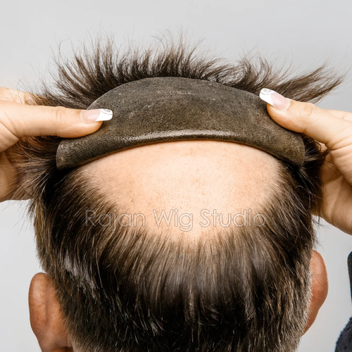 Hair Patch