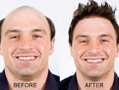 Hair Bonding Service