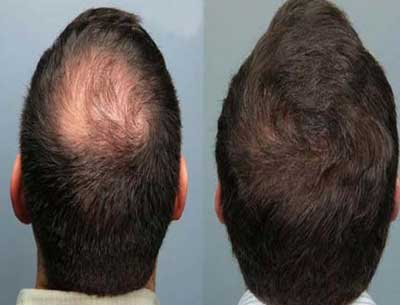 Hair Fixing Service