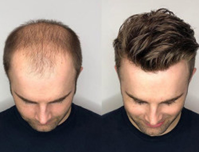 Hair Fixing Service