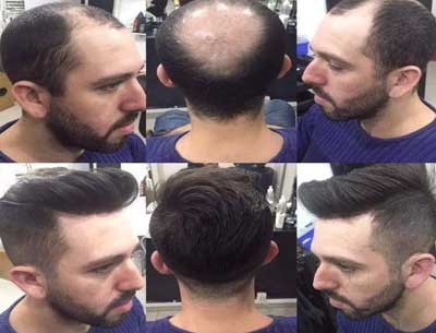Hair weaving services
