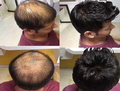 Hair weaving services